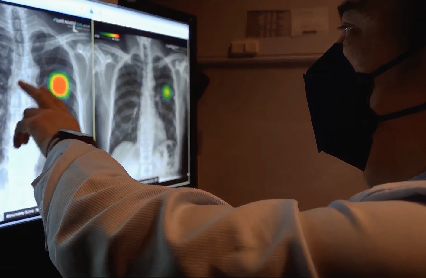 흉부 엑스레이 AI 진단 보조 소프트웨어
