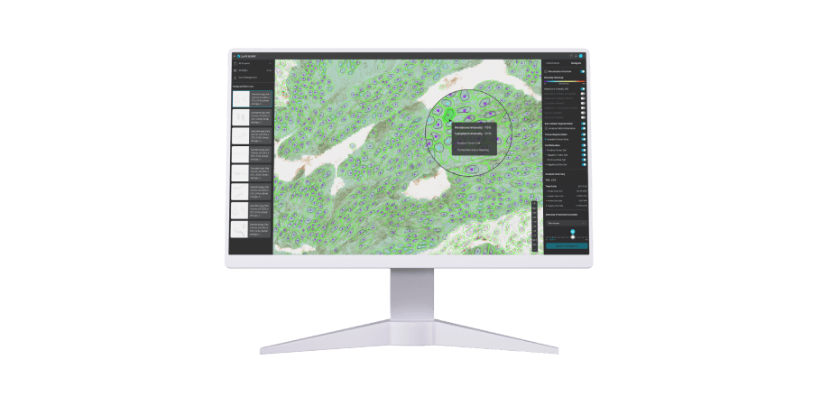 루닛 스코프 IHC면역조직화학(IHC)