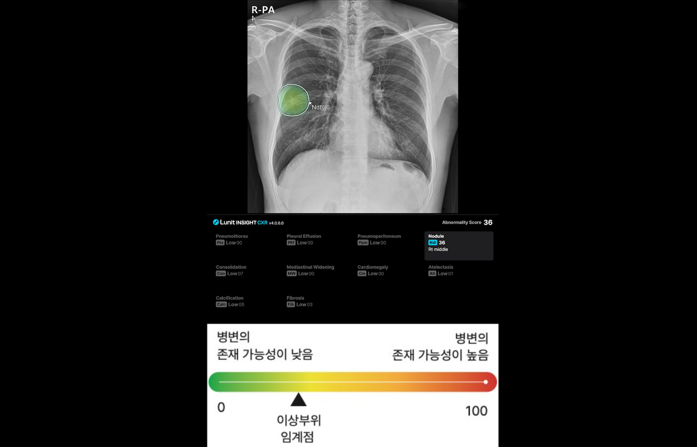 이상 부위 값 표기 및 리포트 제공