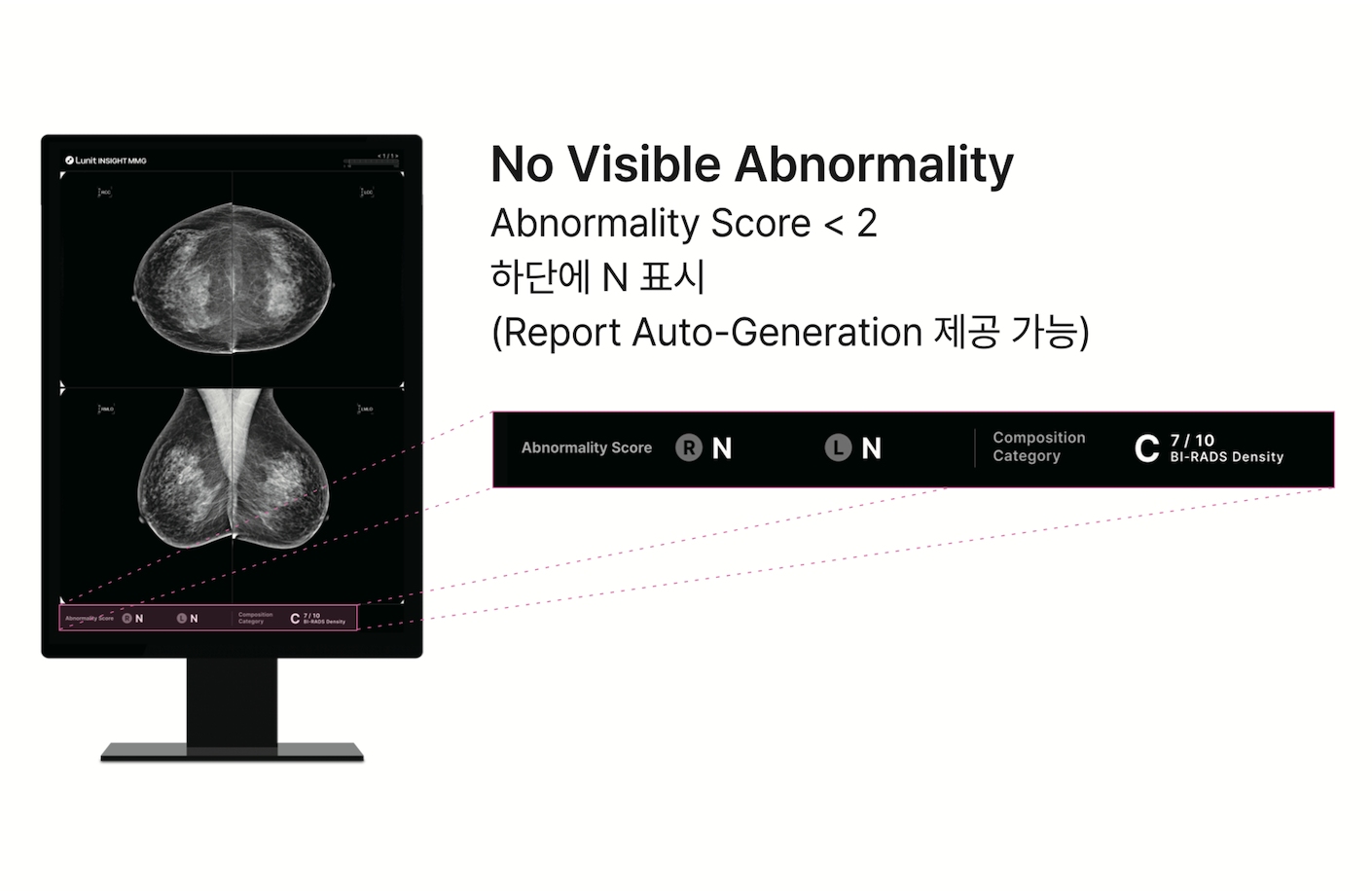 정상 케이스 표시